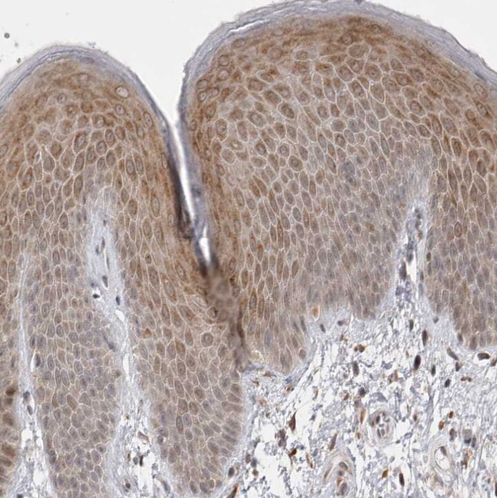GGT6 Antibody - BSA Free