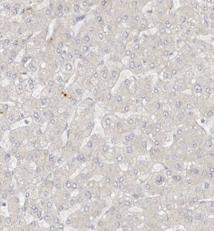 GGT6 Antibody - BSA Free