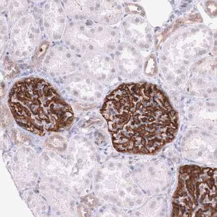 LRRC55 Antibody