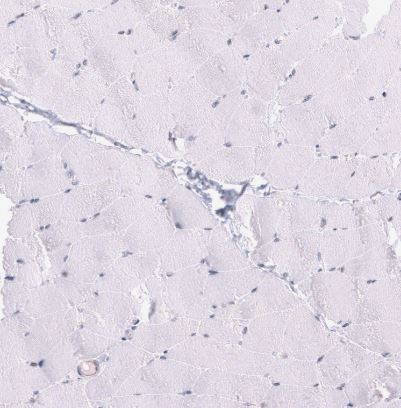 LRRC55 Antibody