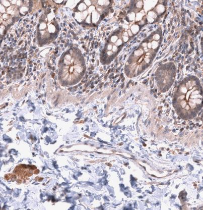 LRRC55 Antibody