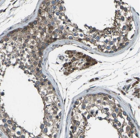 LSMEM1 Antibody