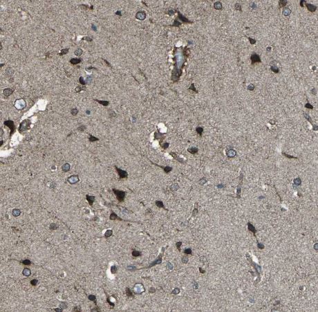 LSMEM1 Antibody