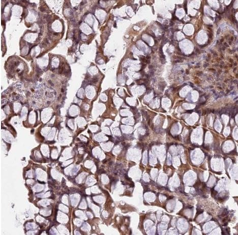 PRELID2 Antibody