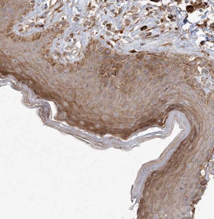 RNF145 Antibody - BSA Free