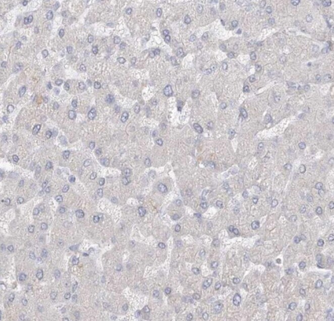 RNF145 Antibody - BSA Free