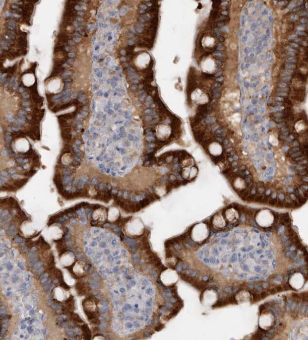 LRRC40 Antibody - BSA Free