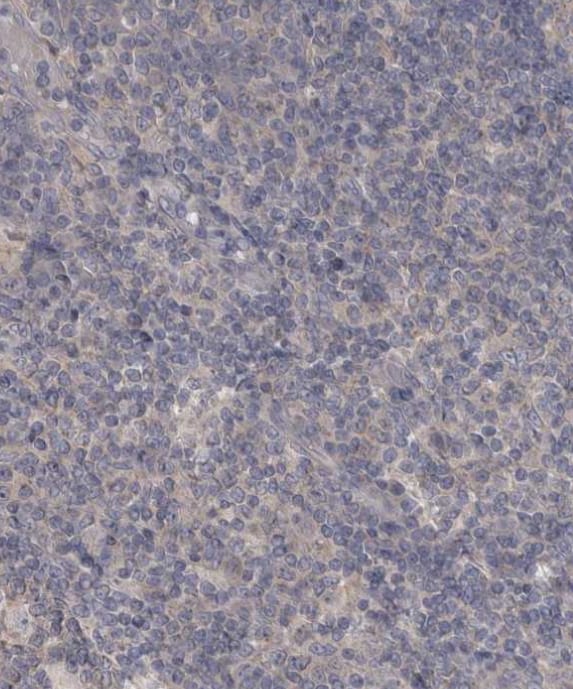LRRC40 Antibody - BSA Free