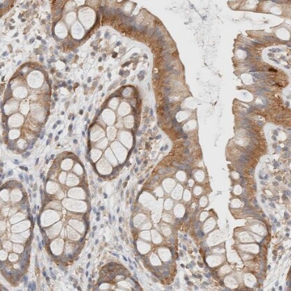 TBC1D8B Antibody - BSA Free