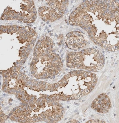 TBC1D8B Antibody - BSA Free
