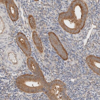 TBC1D8B Antibody - BSA Free