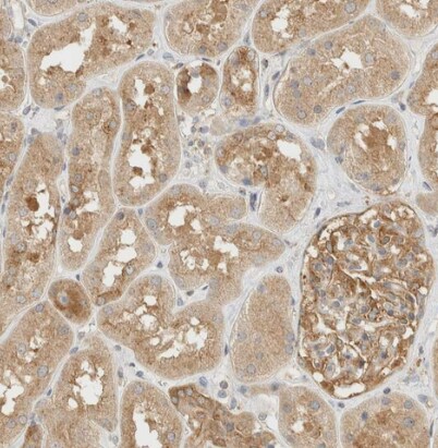 TBC1D8B Antibody - BSA Free