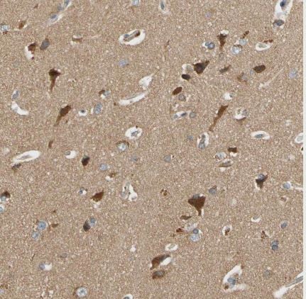 USP46 Antibody