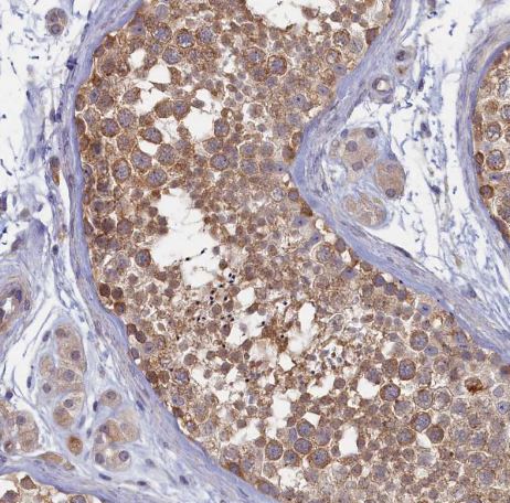 WDR59 Antibody
