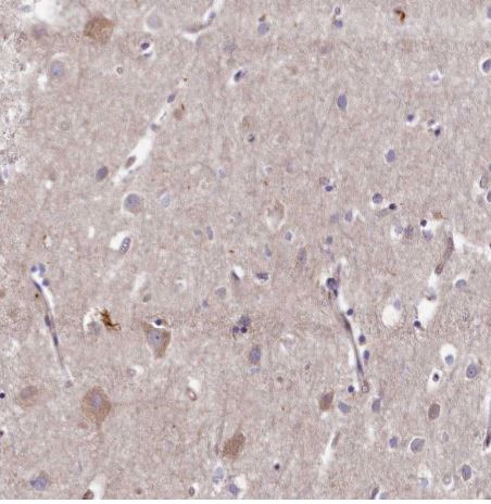 WDR59 Antibody
