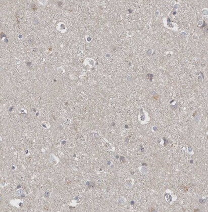 P2Y10/P2RY10 Antibody