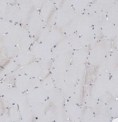 P2Y10/P2RY10 Antibody