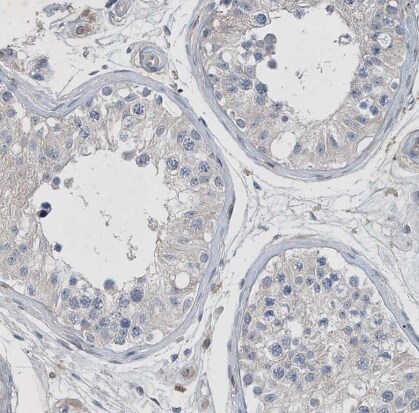P2Y10/P2RY10 Antibody