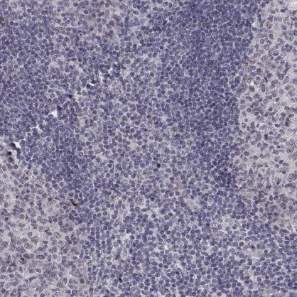 SIX6 Antibody