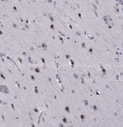 SIX6 Antibody