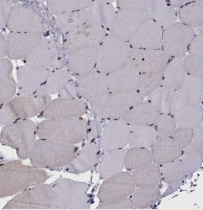 SIX6 Antibody