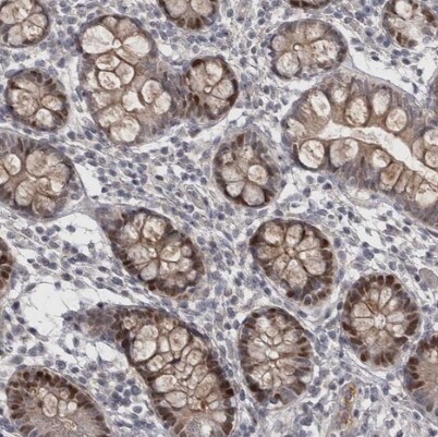 ZNF277 Antibody - BSA Free