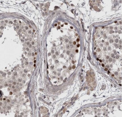 ZNF277 Antibody - BSA Free