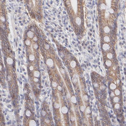 PBDC1 Antibody