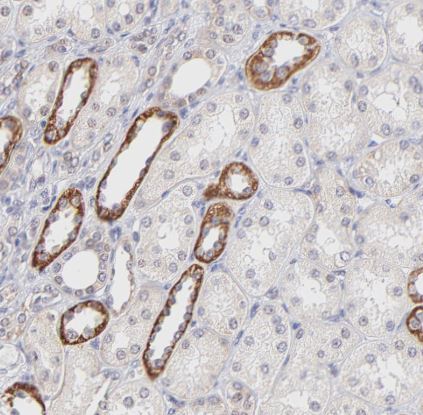 PBDC1 Antibody