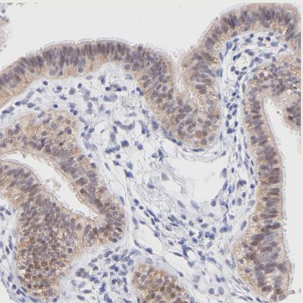 PBDC1 Antibody