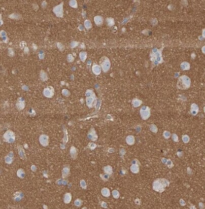 Fyn Antibody