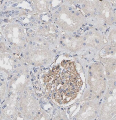 Fyn Antibody