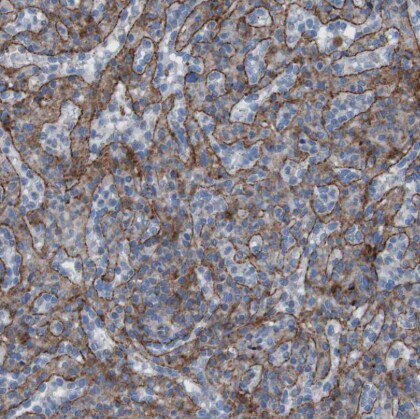 RNF182 Antibody