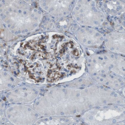 RNF182 Antibody