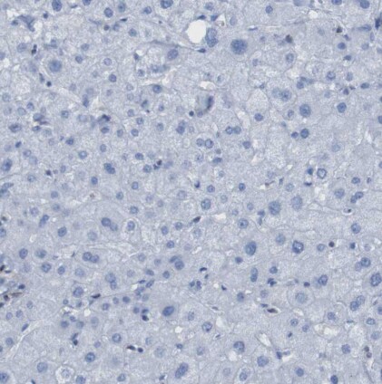 RNF182 Antibody