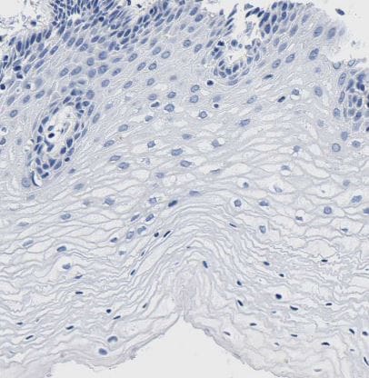 LSECtin/CLEC4G Antibody