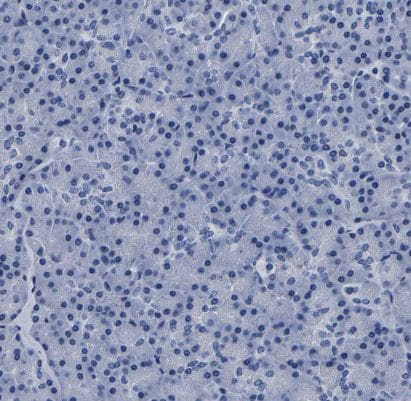 LSECtin/CLEC4G Antibody