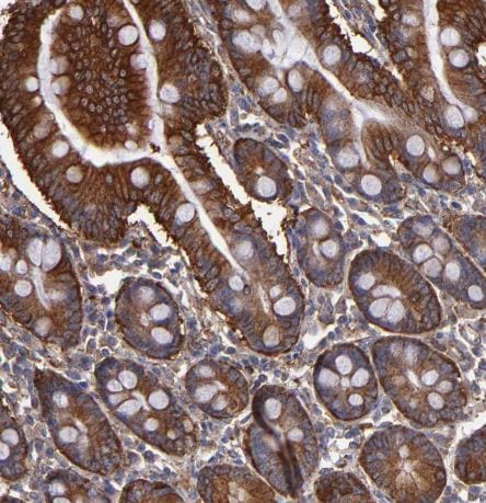 MVP Antibody