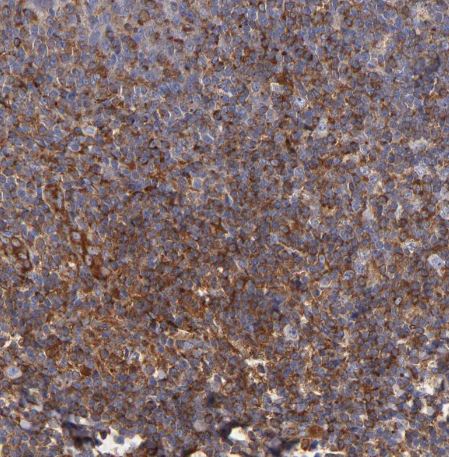 MVP Antibody