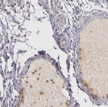 LRG1 Antibody