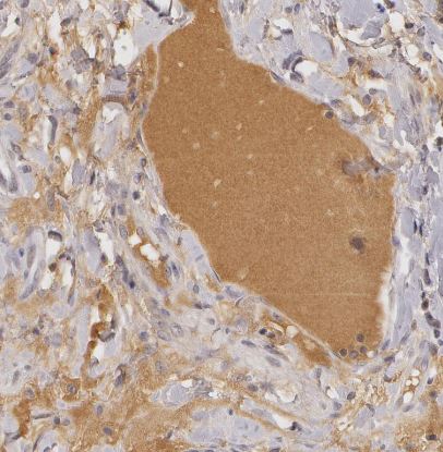 LRG1 Antibody