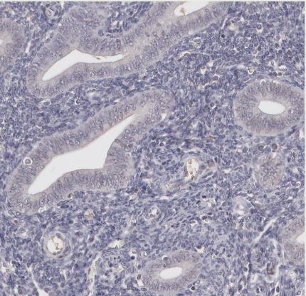 LRG1 Antibody