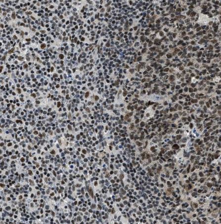 SSB Antibody