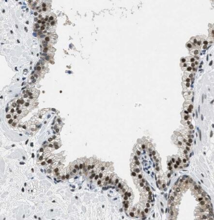 SSB Antibody