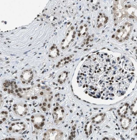 SSB Antibody