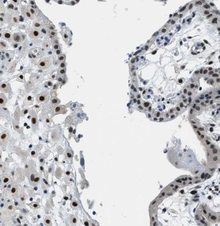 SSB Antibody