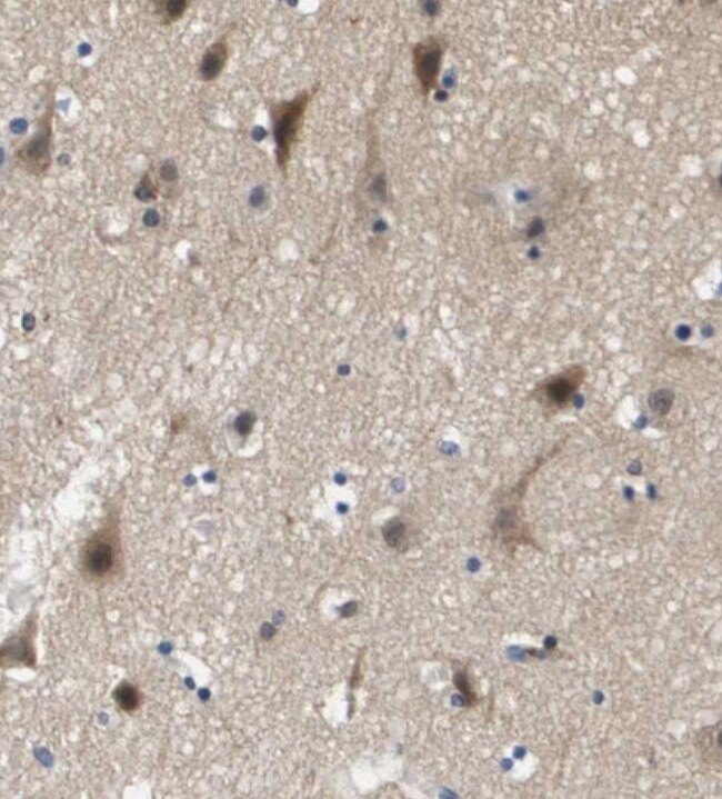 Kv7.5 Antibody - BSA Free