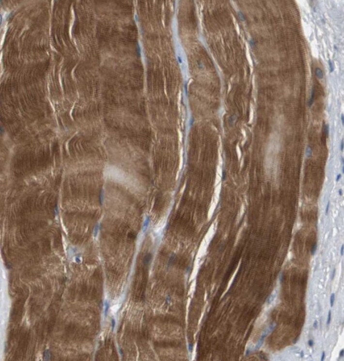 Kv7.5 Antibody - BSA Free