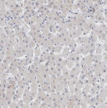 KCNJ1 Antibody