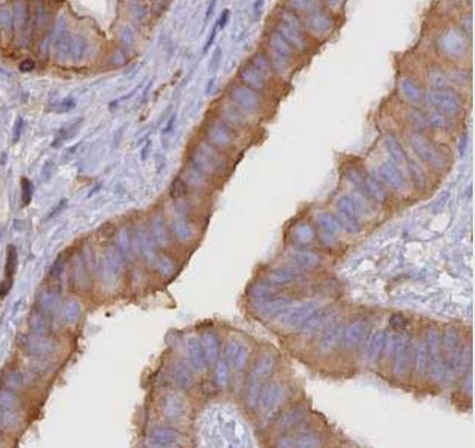VPS18 Antibody